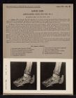 Lower Limb. Articulations. Ankle and Foot - no. 2
